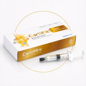 CartiPRO – Vật liệu bổ sung mô collagen hỗ trợ phục hồi vùng sụn tổn thương
